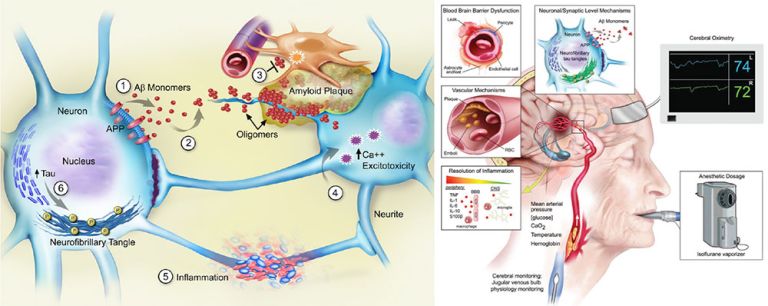 Peri-Operative Neurocognitive Research Team Laboratory