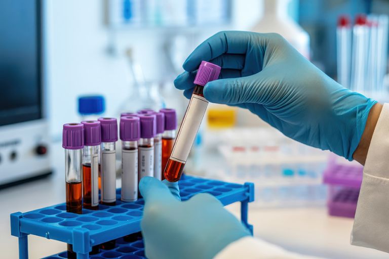 Scientist in blue gloves handling blood samples in a laboratory